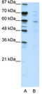 CBFA2/RUNX1 Partner Transcriptional Co-Repressor 3 antibody, TA343514, Origene, Western Blot image 