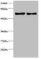 C-C Motif Chemokine Ligand 5 antibody, A51637-100, Epigentek, Western Blot image 
