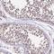 Chromosome 4 Open Reading Frame 47 antibody, NBP1-93540, Novus Biologicals, Immunohistochemistry frozen image 