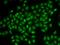Lysophosphatidylcholine acyltransferase 1 antibody, orb373271, Biorbyt, Immunofluorescence image 