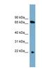 Solute Carrier Family 24 Member 4 antibody, NBP1-59897, Novus Biologicals, Western Blot image 