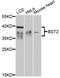 CD317 antibody, 14-361, ProSci, Western Blot image 
