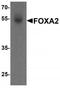 Forkhead Box A2 antibody, TA319660, Origene, Western Blot image 
