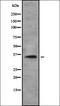 Solute Carrier Family 39 Member 2 antibody, orb378450, Biorbyt, Western Blot image 