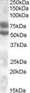 Dachshund Family Transcription Factor 1 antibody, PA5-18909, Invitrogen Antibodies, Western Blot image 