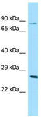Autoantigen NOR-90 antibody, TA343724, Origene, Western Blot image 