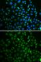 SS-A antibody, GTX65834, GeneTex, Immunofluorescence image 