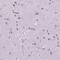Zinc Finger Protein 853 antibody, NBP2-49527, Novus Biologicals, Immunohistochemistry paraffin image 