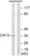 Carbonic anhydrase 13 antibody, abx014309, Abbexa, Western Blot image 