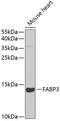 Fatty Acid Binding Protein 3 antibody, GTX33190, GeneTex, Western Blot image 