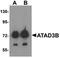Protein numb homolog antibody, orb75613, Biorbyt, Western Blot image 