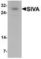 SIVA1 Apoptosis Inducing Factor antibody, PA5-72741, Invitrogen Antibodies, Western Blot image 
