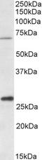 Carnitine O-palmitoyltransferase 2, mitochondrial antibody, orb20557, Biorbyt, Western Blot image 