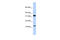 BTF3L1 antibody, 25-270, ProSci, Western Blot image 