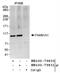 Family With Sequence Similarity 91 Member A1 antibody, NB100-79831, Novus Biologicals, Immunoprecipitation image 