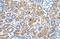 Solute Carrier Family 38 Member 1 antibody, A04461, Boster Biological Technology, Immunohistochemistry paraffin image 