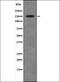 Apoptotic Chromatin Condensation Inducer 1 antibody, orb335905, Biorbyt, Western Blot image 