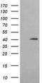 Acetyl-CoA Acyltransferase 2 antibody, TA506158S, Origene, Western Blot image 