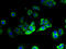 3-Hydroxyacyl-CoA Dehydratase 2 antibody, A65662-100, Epigentek, Immunofluorescence image 