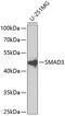 SMAD Family Member 3 antibody, 14-008, ProSci, Western Blot image 