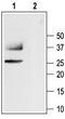 Aquaporin 1 (Colton Blood Group) antibody, TA328656, Origene, Western Blot image 
