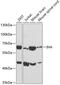 Internexin Neuronal Intermediate Filament Protein Alpha antibody, GTX33004, GeneTex, Western Blot image 