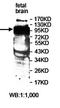Zinc Finger Protein 473 antibody, orb78119, Biorbyt, Western Blot image 