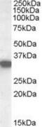 Had antibody, NB100-77343, Novus Biologicals, Western Blot image 