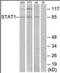 Signal Transducer And Activator Of Transcription 1 antibody, orb94860, Biorbyt, Western Blot image 