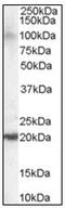 ADP Ribosylation Factor Like GTPase 6 Interacting Protein 5 antibody, AP23816PU-N, Origene, Western Blot image 