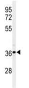 NAD-dependent deacetylase sirtuin-3, mitochondrial antibody, ab86671, Abcam, Western Blot image 