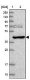 NADH:Ubiquinone Oxidoreductase Complex Assembly Factor 6 antibody, PA5-61446, Invitrogen Antibodies, Western Blot image 