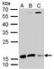 Destrin antibody, GTX114170, GeneTex, Western Blot image 