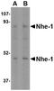 Solute Carrier Family 9 Member A1 antibody, NBP1-76847, Novus Biologicals, Western Blot image 