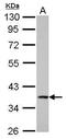 Cathepsin S antibody, GTX103988, GeneTex, Western Blot image 