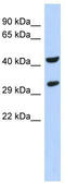 Ankyrin Repeat And SOCS Box Containing 8 antibody, TA340198, Origene, Western Blot image 