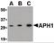 Aph-1 Homolog A, Gamma-Secretase Subunit antibody, orb86678, Biorbyt, Western Blot image 