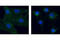 Platelet Derived Growth Factor Receptor Beta antibody, 3169S, Cell Signaling Technology, Immunofluorescence image 