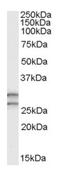 Catechol O-methyltransferase antibody, AP16308PU-N, Origene, Western Blot image 