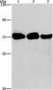 Phosphatidylinositol-4-Phosphate 5-Kinase Type 1 Alpha antibody, PA5-50346, Invitrogen Antibodies, Western Blot image 