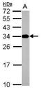 ATPase H+ Transporting V1 Subunit E2 antibody, PA5-29206, Invitrogen Antibodies, Western Blot image 