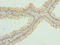 Lysine-specific demethylase 5A antibody, LS-C318116, Lifespan Biosciences, Immunohistochemistry paraffin image 