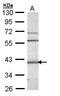 Calcium/Calmodulin Dependent Protein Kinase ID antibody, GTX108565, GeneTex, Western Blot image 