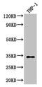 Capping Actin Protein Of Muscle Z-Line Subunit Alpha 1 antibody, CSB-PA004510LA01HU, Cusabio, Western Blot image 