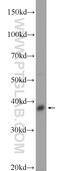 DSN1 Component Of MIS12 Kinetochore Complex antibody, 17742-1-AP, Proteintech Group, Western Blot image 