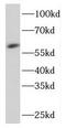 Pyruvate Kinase L/R antibody, FNab06491, FineTest, Western Blot image 
