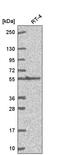 Gamma-glutamyltranspeptidase 1 antibody, HPA065444, Atlas Antibodies, Western Blot image 