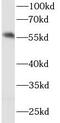 Interferon regulatory factor 5 antibody, FNab04392, FineTest, Western Blot image 