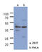 N-Acetylglucosamine Kinase antibody, AM50019PU-S, Origene, Western Blot image 