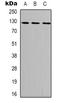 Protein Tyrosine Kinase 2 antibody, orb338933, Biorbyt, Western Blot image 